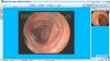 肠镜影像工作站软件