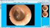 耳鼻喉影像工作站软件